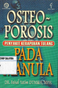 Osteoporosis : Penyakit Kerapuhan Tulang Pada Manula